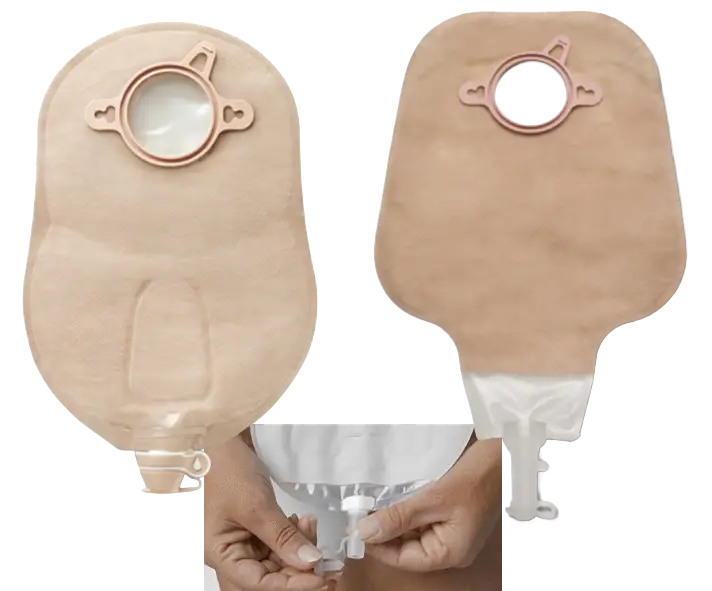 Urostomie